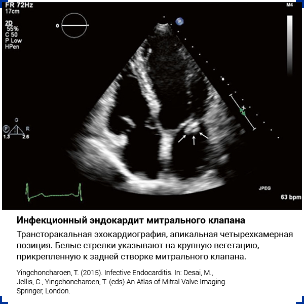 Инструментальные исследования